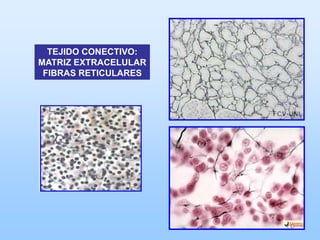 TEJIDO CONECTIVO:
MATRIZ EXTRACELULAR
 FIBRAS RETICULARES
 
