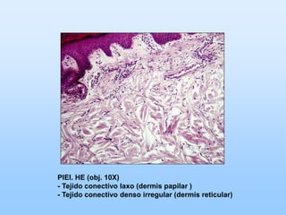 PIEl. HE (obj. 10X)
- Tejido conectivo laxo (dermis papilar )
- Tejido conectivo denso irregular (dermis reticular)
 