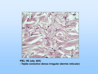 PIEl. HE (obj. 40X)
- Tejido conectivo denso irregular (dermis reticular)
 
