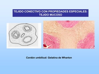 TEJIDO CONECTIVO CON PROPIEDADES ESPECIALES:
               TEJIDO MUCOSO




       Cordón umbilical: Gelatina de Wharton
 