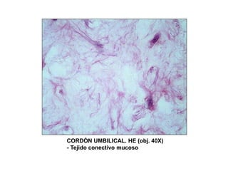 CORDÓN UMBILICAL. HE (obj. 40X)
- Tejido conectivo mucoso
 