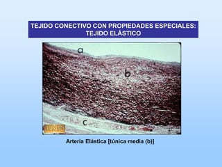 TEJIDO CONECTIVO CON PROPIEDADES ESPECIALES:
               TEJIDO ELÁSTICO




         Arteria Elástica [túnica media (b)]
 