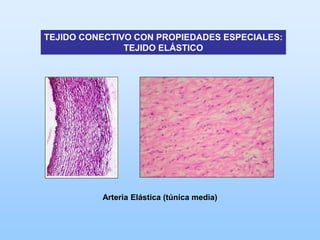 TEJIDO CONECTIVO CON PROPIEDADES ESPECIALES:
               TEJIDO ELÁSTICO




          Arteria Elástica (túnica media)
 