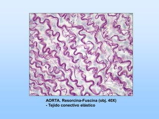 AORTA. Resorcina-Fuscina (obj. 40X)
- Tejido conectivo elástico
 