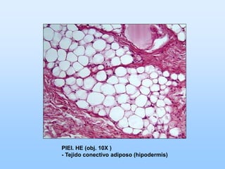 PIEl. HE (obj. 10X )
- Tejido conectivo adiposo (hipodermis)
 