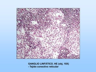 GANGLIO LINFÁTICO. HE (obj. 10X)
- Tejido conectivo reticular
 