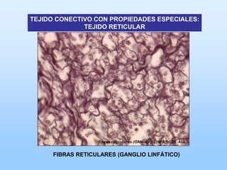 TEJIDO CONECTIVO CON PROPIEDADES ESPECIALES:
              TEJIDO RETICULAR




      FIBRAS RETICULARES (GANGLIO LINFÁTICO)
 