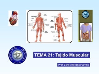 TEMA 21: Tejido Muscular

          Prof. Carlos Mendoza Gaviria
 