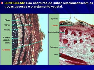 LENTICELAS:  São aberturas do súber relacionadascom as trocas gasosas e o arejamento vegetal.  