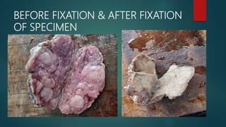 BEFORE FIXATION & AFTER FIXATION
OF SPECIMEN
 