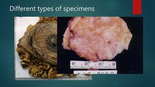 Different types of specimens
 