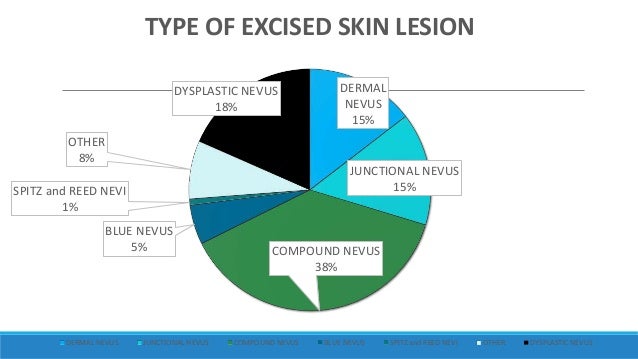colordial nevus