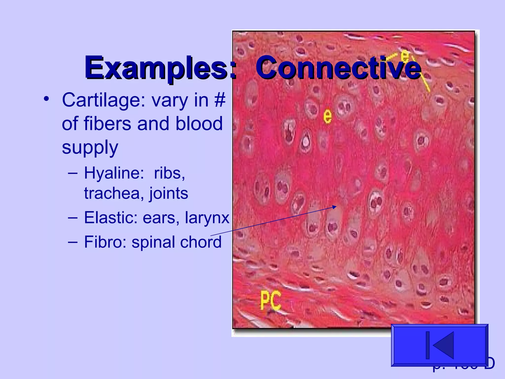 Examples: ConnectiveExamples: Connective
• Cartilage: vary in #
of fibers and blood
supply
– Hyaline: ribs,
trachea, joints
– Elastic: ears, larynx
– Fibro: spinal chord
p. 160 D
 