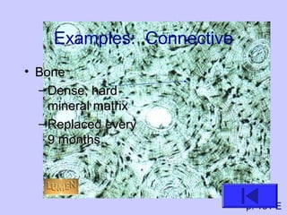 Examples: Connective
• BoneBone
– Dense, hardDense, hard
mineral matrixmineral matrix
– Replaced everyReplaced every
9 months.9 months.
p. 161 E
 