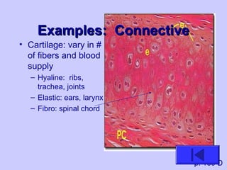 Examples: ConnectiveExamples: Connective
• Cartilage: vary in #
of fibers and blood
supply
– Hyaline: ribs,
trachea, joints
– Elastic: ears, larynx
– Fibro: spinal chord
p. 160 D
 