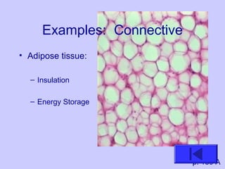 Examples: Connective
• Adipose tissue:
– Insulation
– Energy Storage
p. 159 A
 