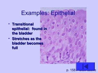 Examples: Epithelial
• TransitionalTransitional
epithelial: found inepithelial: found in
the bladderthe bladder
• Stretches as theStretches as the
bladder becomesbladder becomes
fullfull
p. 158 F draw above
 