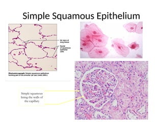 Simple Squamous Epithelium
Simple squamous
lining the walls of
the capillary
If it’s from a
mesothelial lining
 