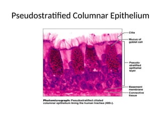 Pseudostratified Columnar Epithelium
 