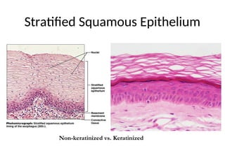 Stratified Squamous Epithelium
Non-keratinized vs. Keratinized
 