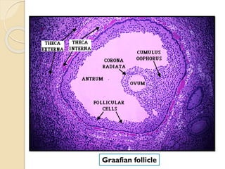 Graafian follicle
 