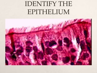 IDENTIFY THE 
EPITHELIUM 
 