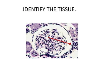 IDENTIFY THE TISSUE.
 