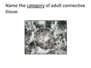 Name the category of adult connective
tissue.
 