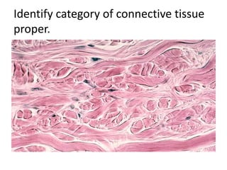 Identify category of connective tissue
proper.
 