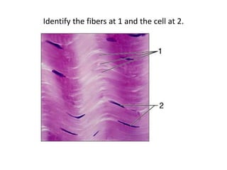 Identify the fibers at 1 and the cell at 2.
 