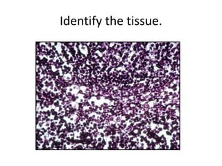 Identify the tissue.
 