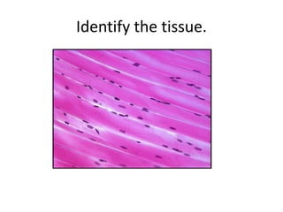 Identify the tissue.
 