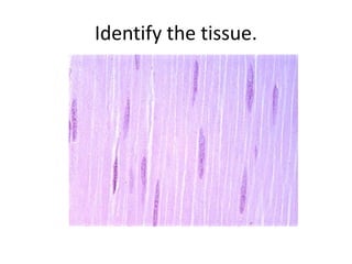 Identify the tissue.
 