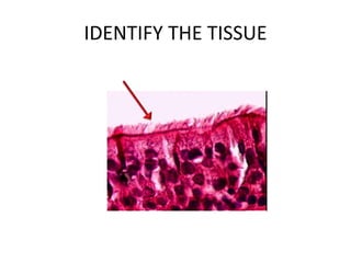 IDENTIFY THE TISSUE
 