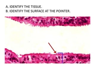 A. IDENTIFY THE TISSUE.
B. IDENTIFY THE SURFACE AT THE POINTER.
 
