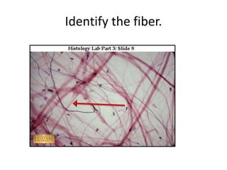 Identify the fiber.
 