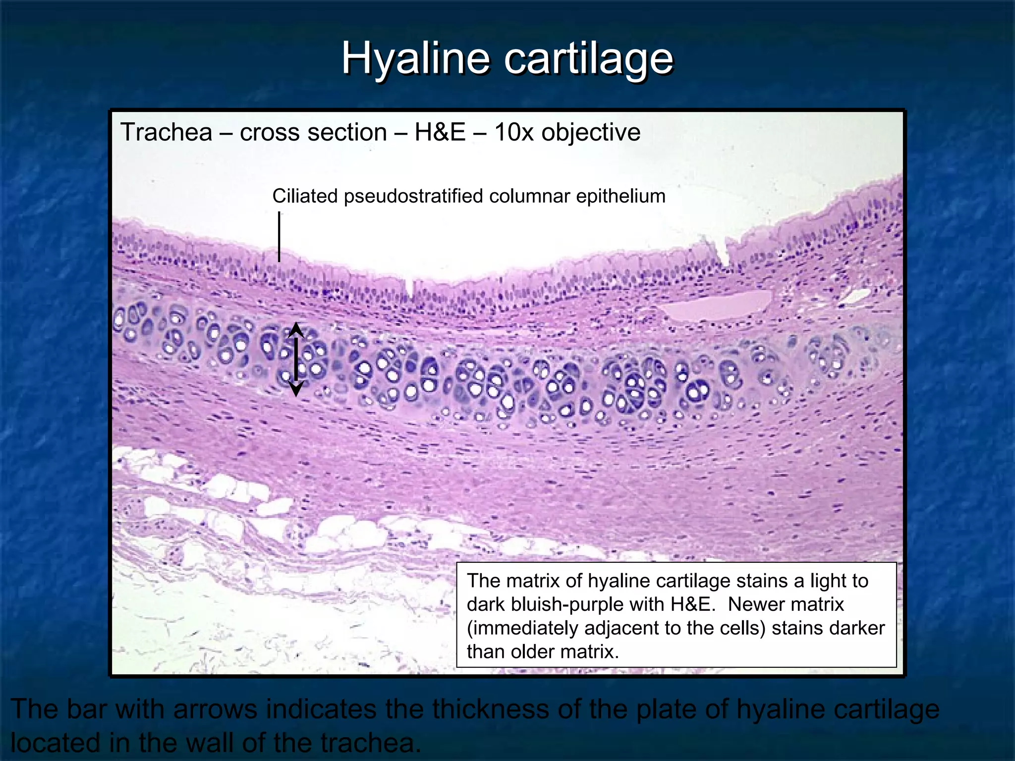 HHyyaalliinnee ccaarrttiillaaggee 
Trachea – cross section – H&E – 10x objective 
Ciliated pseudostratified columnar epithelium 
The matrix of hyaline cartilage stains a light to 
dark bluish-purple with H&E. Newer matrix 
(immediately adjacent to the cells) stains darker 
than older matrix. 
The bar with arrows indicates the thickness of the plate of hyaline cartilage 
located in the wall of the trachea. 
 