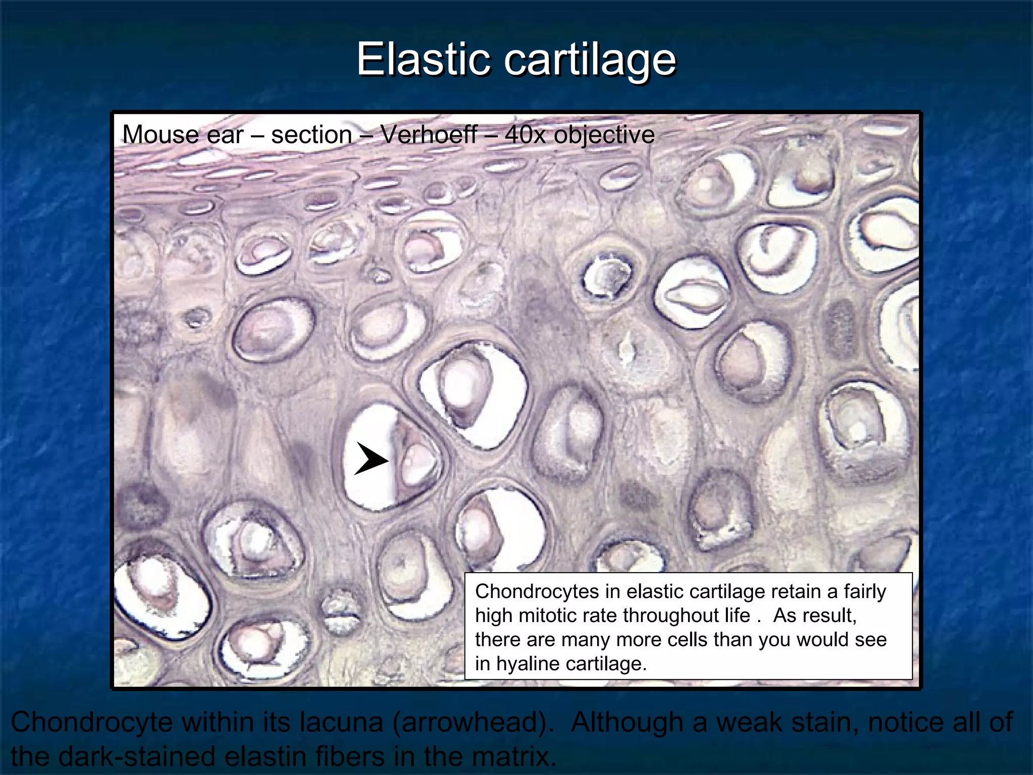 EEllaassttiicc ccaarrttiillaaggee 
Mouse ear – section – Verhoeff – 40x objective 
Chondrocytes in elastic cartilage retain a fairly 
high mitotic rate throughout life . As result, 
there are many more cells than you would see 
in hyaline cartilage. 
Chondrocyte within its lacuna (arrowhead). Although a weak stain, notice all of 
the dark-stained elastin fibers in the matrix. 
 