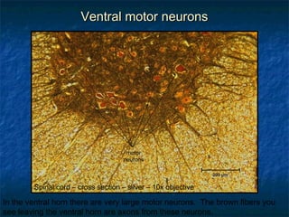 VVeennttrraall mmoottoorr nneeuurroonnss 
motor 
neurons 
Spinal cord – cross section – silver – 10x objective 
In the ventral horn there are very large motor neurons. The brown fibers you 
see leaving the ventral horn are axons from these neurons. 
 
