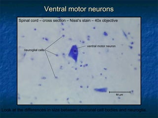 VVeennttrraall mmoottoorr nneeuurroonnss 
Spinal cord – cross section – Nissl’s stain – 40x objective 
neuroglial cells 
ventral motor neuron 
Look at the differences in size between neuronal cell bodies and neuroglia. 
 