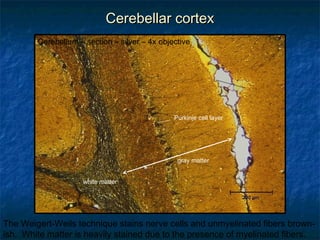 CCeerreebbeellllaarr ccoorrtteexx 
Cerebellum – section – silver – 4x objective 
white matter 
Purkinje cell layer 
gray matter 
The Weigert-Weils technique stains nerve cells and unmyelinated fibers brown-ish. 
White matter is heavily stained due to the presence of myelinated fibers. 
 