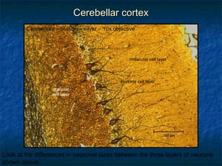 CCeerreebbeellllaarr ccoorrtteexx 
Cerebellum – section – silver – 10x objective 
granular 
cell layer 
molecular cell layer 
Purkinje cell layer 
Look at the differences in neuronal sizes between the three layers of neurons 
shown above. 
 
