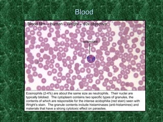 BBlloooodd 
Blood film -- human – Wright – 40x objective 
eosinophil 
Eosinophils (2-4%) are about the same size as neutrophils. Their nuclei are 
typically bilobed. The cytoplasm contains two specific types of granules, the 
contents of which are responsible for the intense acidophilia (red stain) seen with 
Wright’s stain. The granule contents include histaminases (anti-histamines) and 
materials that have a strong cytotoxic effect on parasites. 
 