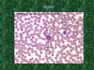 BBlloooodd 
Blood film -- human – Wright – 40x objective 
neutrophil 
eosinophil 
 