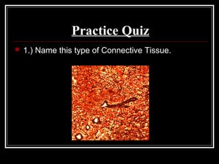 Practice Quiz
 1.) Name this type of Connective Tissue.
 