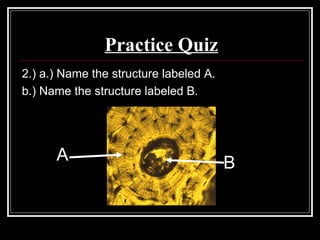 Practice Quiz
2.) a.) Name the structure labeled A.
b.) Name the structure labeled B.
BA
 