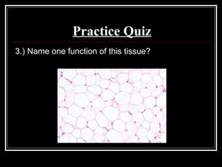 Practice Quiz
3.) Name one function of this tissue?
 