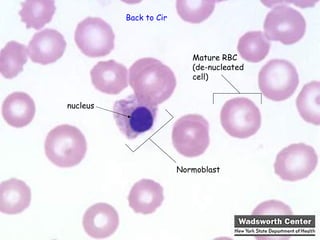 Back to Circulatory System




                          Mature RBC
                          (de-nucleated
                          cell)


nucleus




                      Normoblast
 