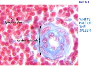 Back to Immu




WHITE
PULP OF
THE
SPLEEN
 