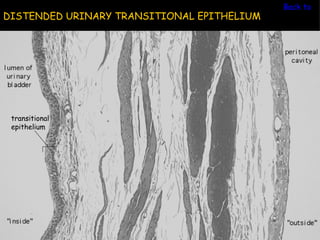 Back to Ur
DISTENDED URINARY TRANSITIONAL EPITHELIUM




 transitional
 epithelium
 